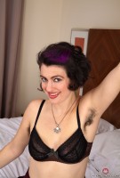 ATK hairy  in mature and hairy