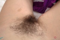 ATK hairy  in mature and hairy