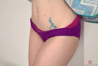 ATK hairy  in mature and hairy