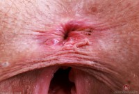 ATK hairy  in young and hairy