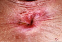 ATK hairy Sahara Skye Set