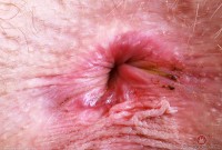 ATK hairy Sahara Skye Set