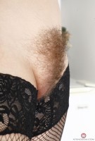ATK hairy  in young and hairy