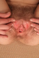 ATK hairy  in young and hairy