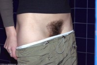 ATK hairy  in young and hairy
