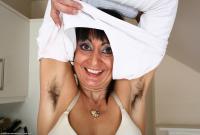 ATK hairy  in mature and hairy