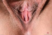 ATK hairy  in mature and hairy