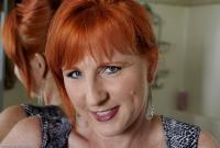 ATK hairy  in mature and hairy