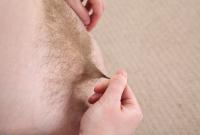 ATK hairy  in young and hairy