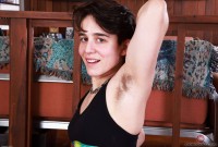 ATK hairy  in mature and hairy