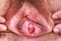 ATK hairy Scout in mature and hairy