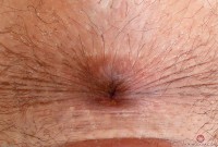 ATK hairy Sedusa D Set