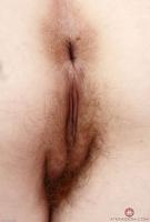ATK hairy  in mature and hairy