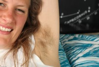 ATK hairy  in young and hairy