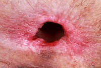 ATK hairy Sia Wood Set