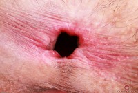 ATK hairy Sia Wood Set