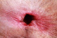 ATK hairy Sia Wood Set