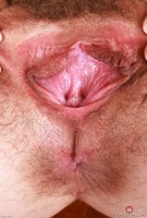 ATK hairy  in young and hairy