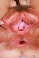 ATK hairy  in young and hairy