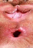 ATK hairy  in young and hairy