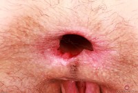 ATK hairy Sia Wood Set