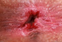 ATK hairy Sia Wood Set