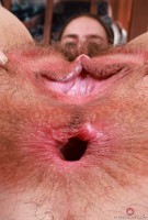 ATK hairy  in young and hairy