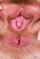 ATK hairy  in young and hairy