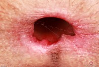 ATK hairy Sia Wood Set