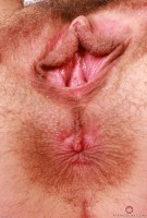 ATK hairy  in young and hairy