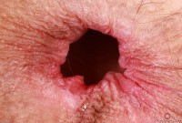 ATK hairy Sia Wood Set