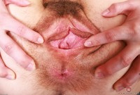 ATK hairy  in young and hairy