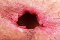 ATK hairy Sia Wood Set