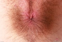 ATK hairy  in young and hairy