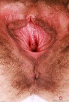 ATK hairy  in young and hairy