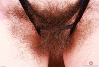ATK hairy  in young and hairy