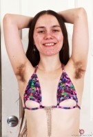 ATK hairy  in young and hairy