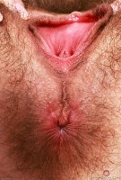 ATK hairy  in young and hairy