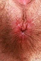 ATK hairy  in young and hairy