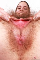 ATK hairy  in young and hairy