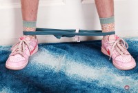 ATK hairy  in young and hairy