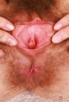 ATK hairy  in young and hairy