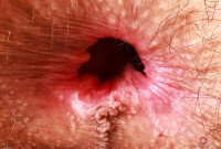 ATK hairy Sia Wood Set