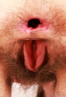 ATK hairy  in young and hairy