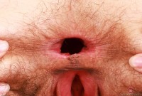 ATK hairy  in young and hairy