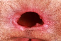 ATK hairy Sia Wood Set