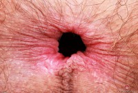 ATK hairy Sia Wood Set