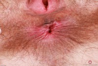 ATK hairy  in young and hairy