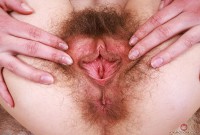ATK hairy  in young and hairy