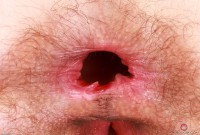 ATK hairy Sia Wood Set